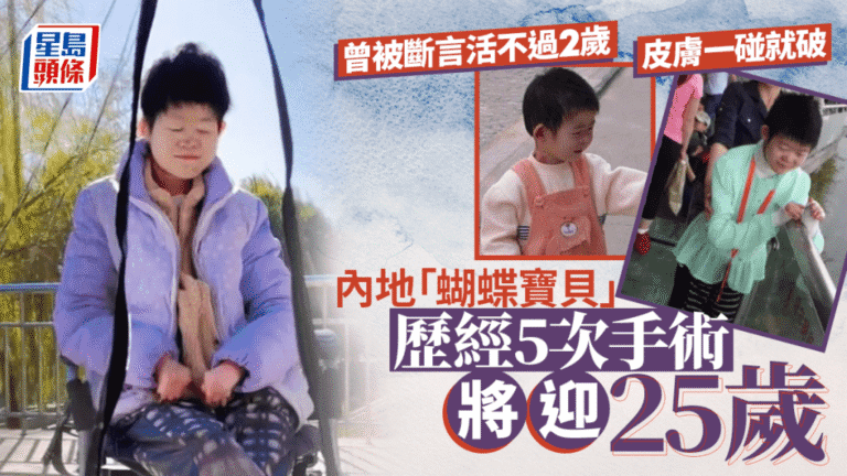 曾被斷言活不過兩歲！「蝴蝶寶貝」高尚好對抗罕病24年：我還能期待明天