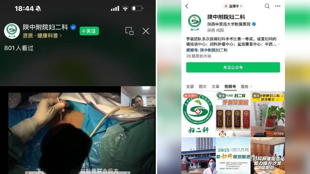 離譜直播！陝西醫院手術過程無遮無掩 女病人私隱部位任睇4分鐘